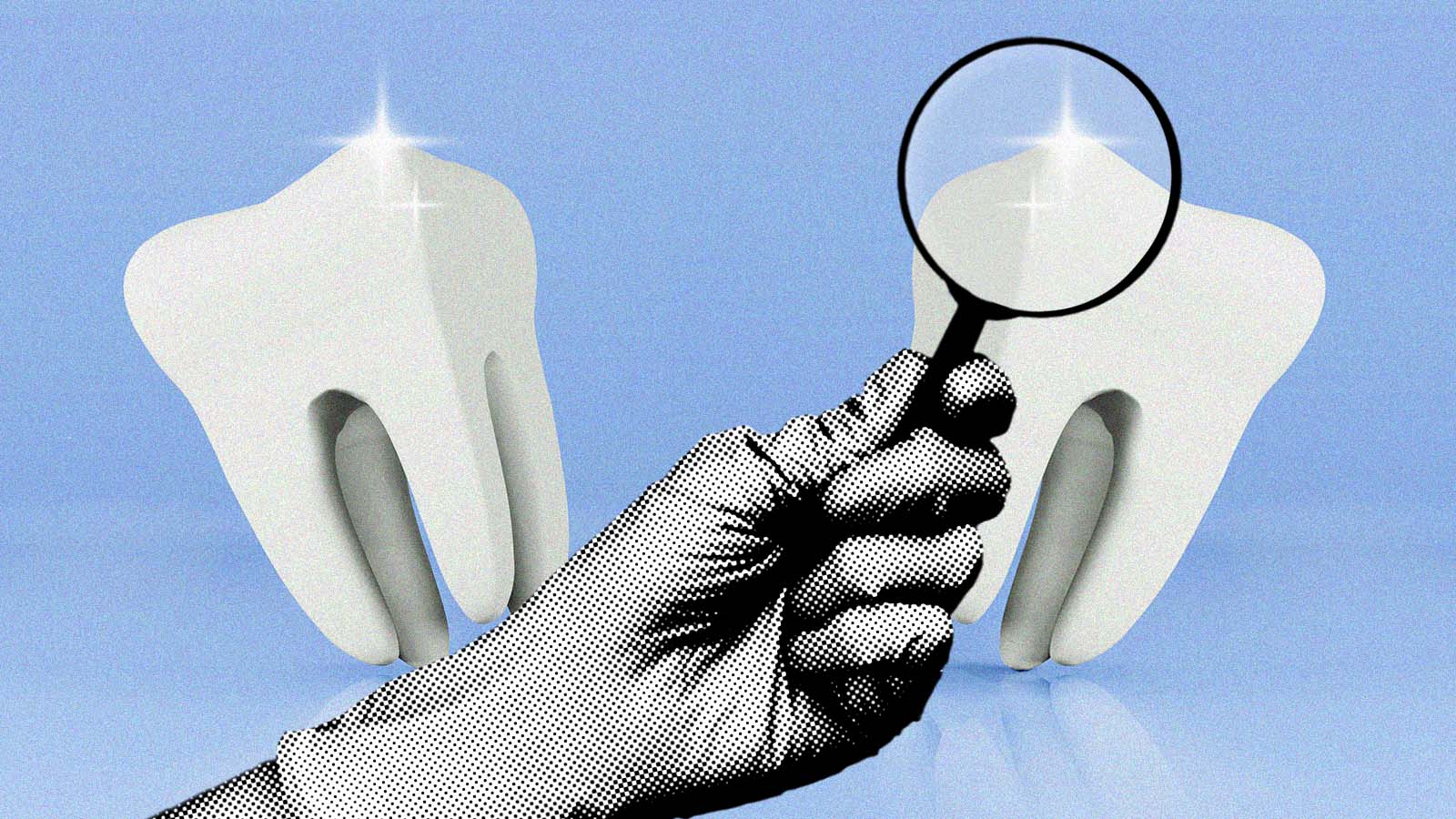 Tratamento sem broca pode interromper cáries em crianças