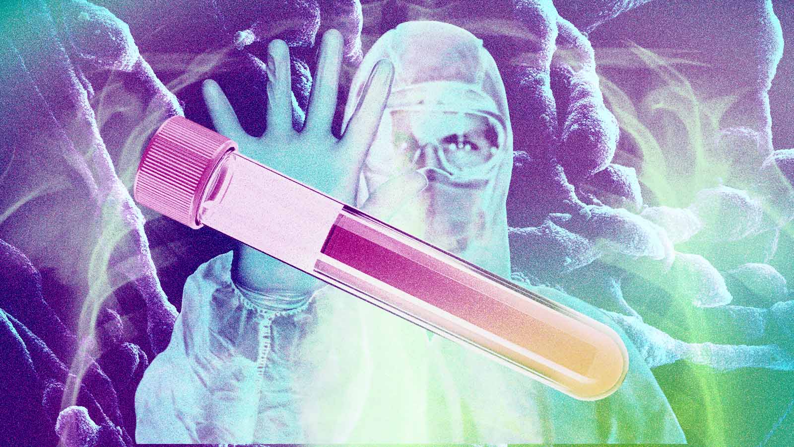 pneumonia ataca funcionários de laboratório na Rússia